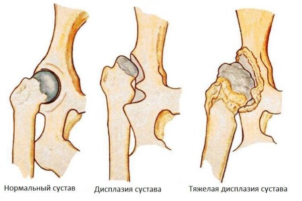 Дисплазия тазобедренного сустава у кошек