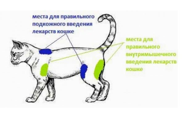 Схема мест для внутримышечного подкожного введения лекарств